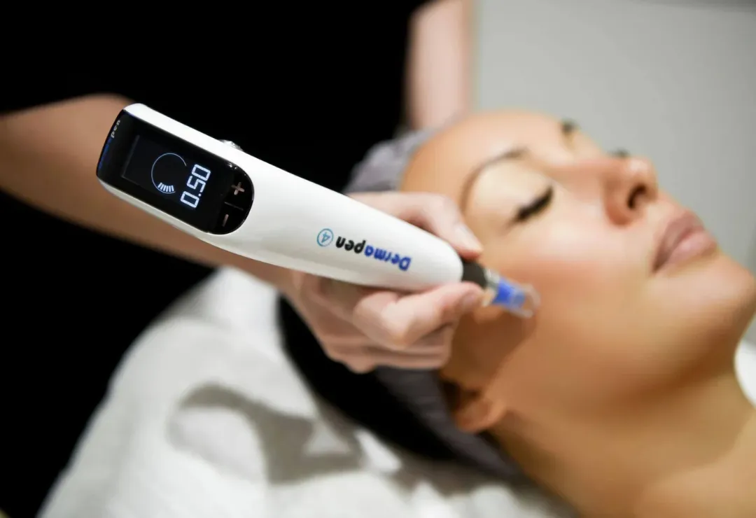 microneedling newport beach ca
