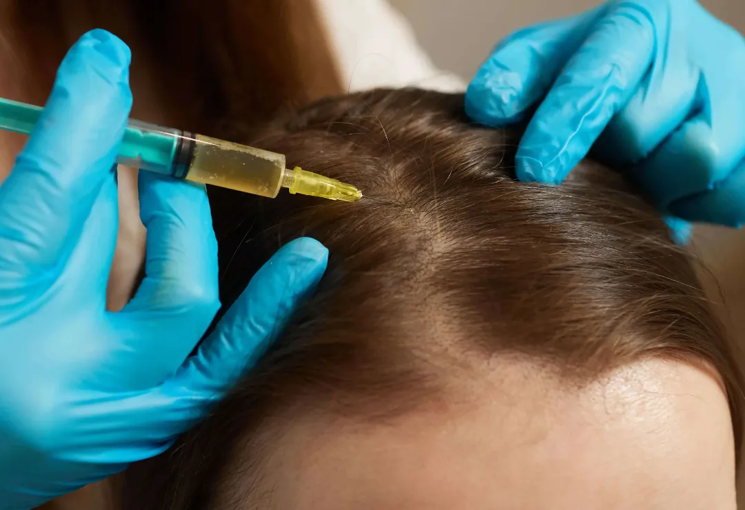 prp for hair newport beach